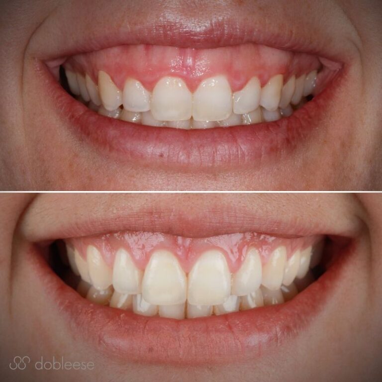 Enfermedad periodontal Tratamiento