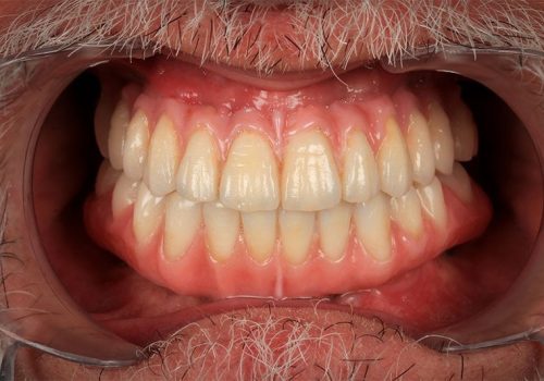 Caso real Miguel. Después del tratamiento dental