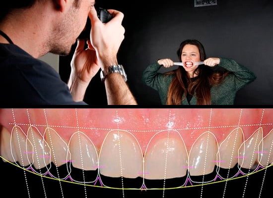 Clínica estética dental Sevilla Clínica estética dental Sevilla