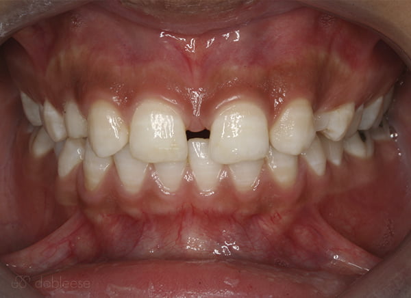 Clínica ortodoncia Sevilla Clínica ortodoncia Sevilla