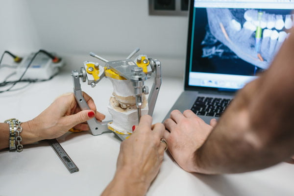 Cuántos implantes dentales se pueden poner en un día