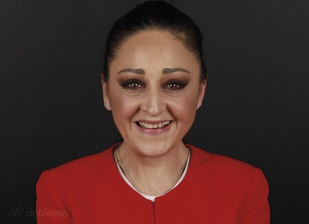 Especialistas Coronas porcelana Sevilla