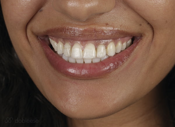 Ortodoncista Sevilla Ortodoncista Sevilla