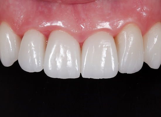 Periodoncista Sevilla Periodoncista Sevilla