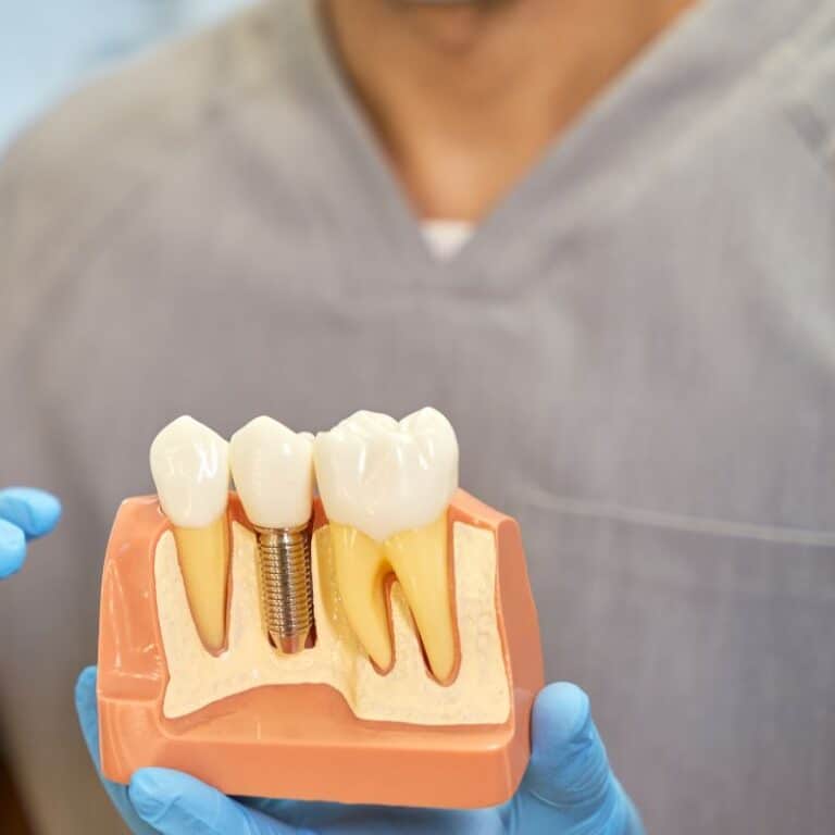 Implante dental que se mueve