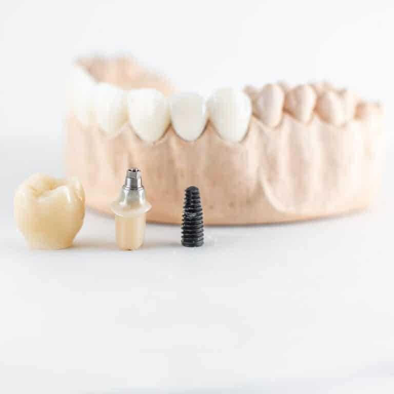 Implante dental se mueve